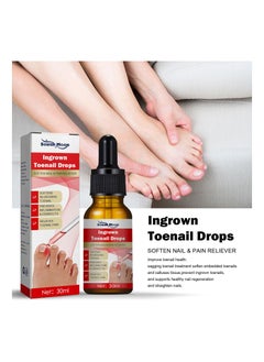 Ingrown Toenail Treatment Drop- Ingrown Toenail Treatment- Cuticle