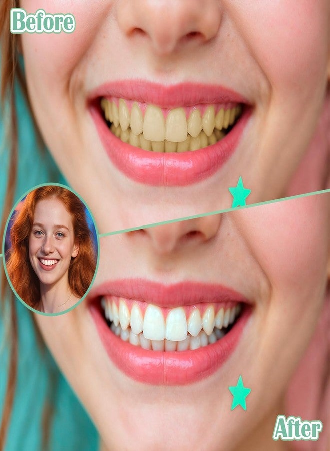 مجموعة SynHHergyx المكونة من 100 قطعة من فرش تنظيف ما بين الأسنان، فرشاة تقويم الأسنان، أدوات تنظيف أسنان أكثر نظافة، أعواد تنظيف أسنان ناعمة للعناية بتقويم الأسنان والجسور، رؤوس قابلة للانحناء محمولة. - Image 5