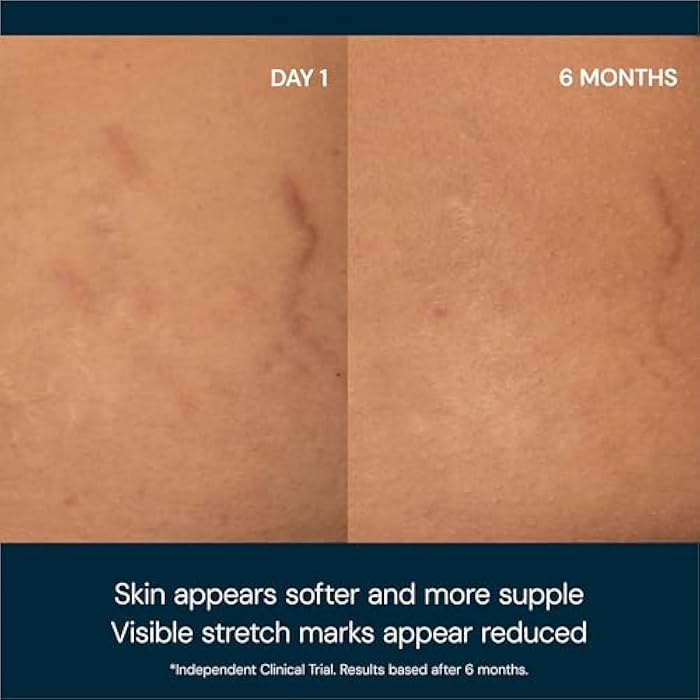 ELEMIS Japanese Camellia Body Oil Blend | Luxuriously Lightweight Body Oil Nourishes, Conditions, and Softens Pregnant and Postpartum Skin | 100 mL - Image 2