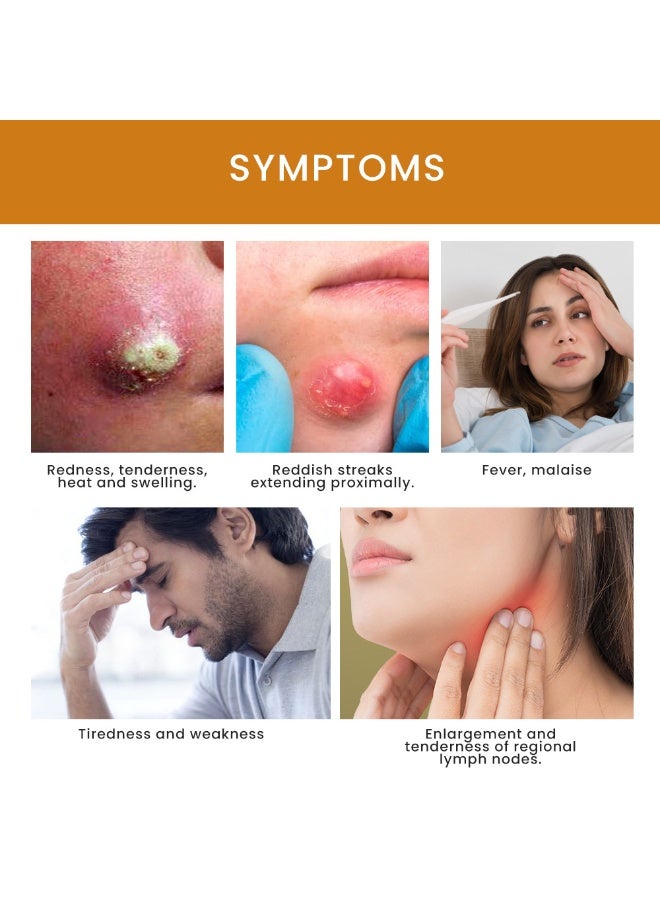 Sumifun Rapid Relief Boil Treatment Cream That Helps Shrink Painful Bumps Calm Inflamed Skin and Support Natural Healing While Providing a Cooling Soothing Sensation for Immediate Comfort - Image 3
