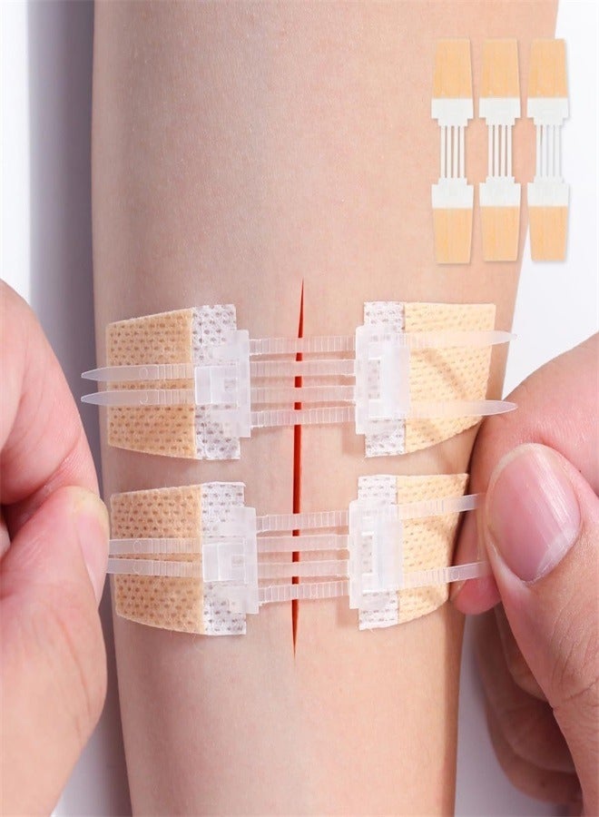 3 Pcs Zip Stitch Wound Closure Device Emergency Zipstitch Laceration Kit Bandages with Steri Strips Painless Laceration Repair Without Stitches Wound Care First Aid - Image 1
