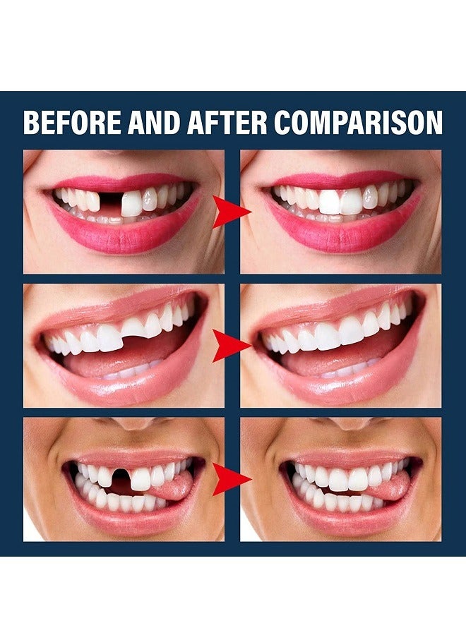 EELHOE 30ml Moldable Teeth Glue 4 Dental Tools Temporary Tooth Filling Set Difficult to Deform Smile Confidently - Image 2