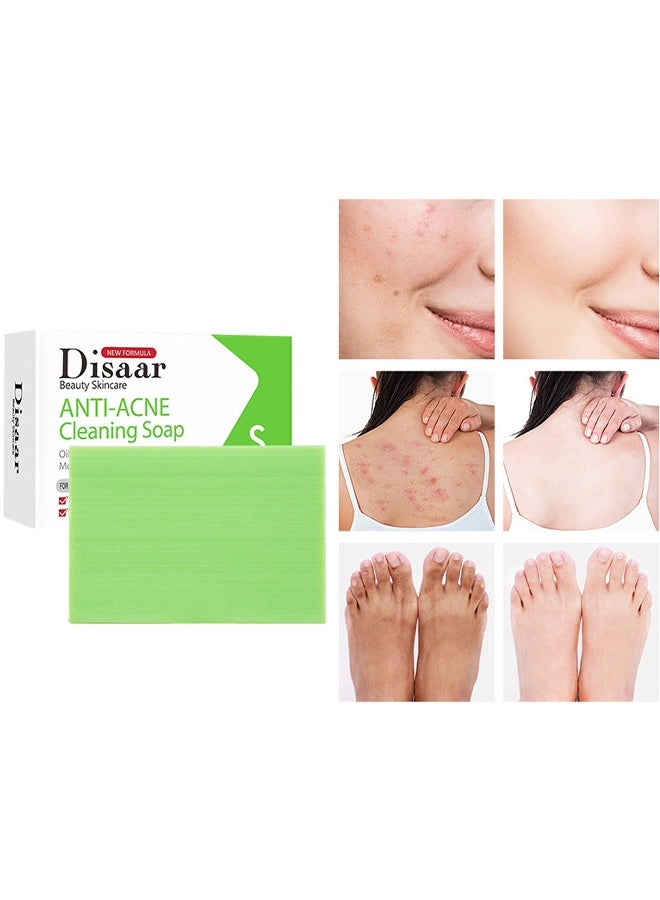 Disaar Salicylic Acid Anti Acne Cleaning Soap, For Face Dry And Natural Oily Skin, Back Acne Lighten, Softening Skin, Removing Acne, Exfoliating, Desalting Acne Mark Moisturizing Skin Cleansing Soap Shower Soap, 100G - Image 1