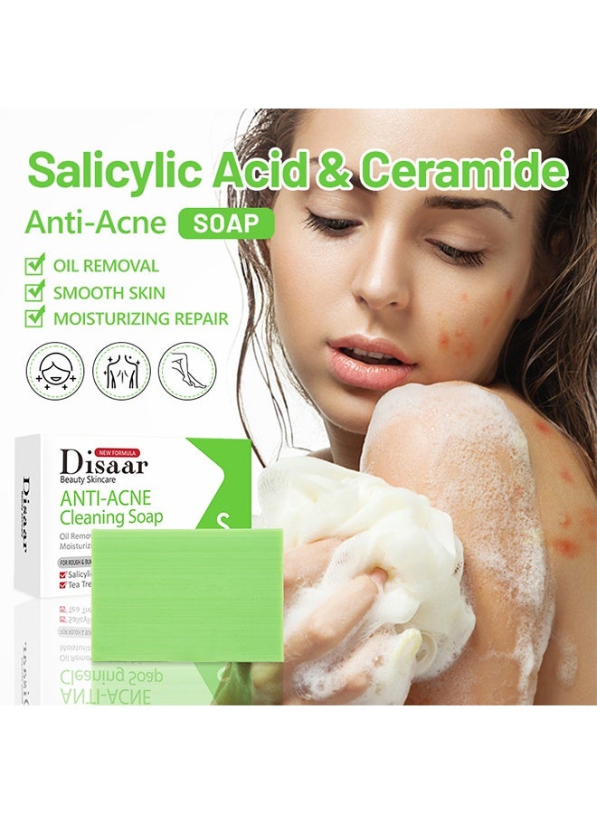 Disaar Salicylic Acid Anti Acne Cleaning Soap, For Face Dry And Natural Oily Skin, Back Acne Lighten, Softening Skin, Removing Acne, Exfoliating, Desalting Acne Mark Moisturizing Skin Cleansing Soap Shower Soap, 100G - Image 2