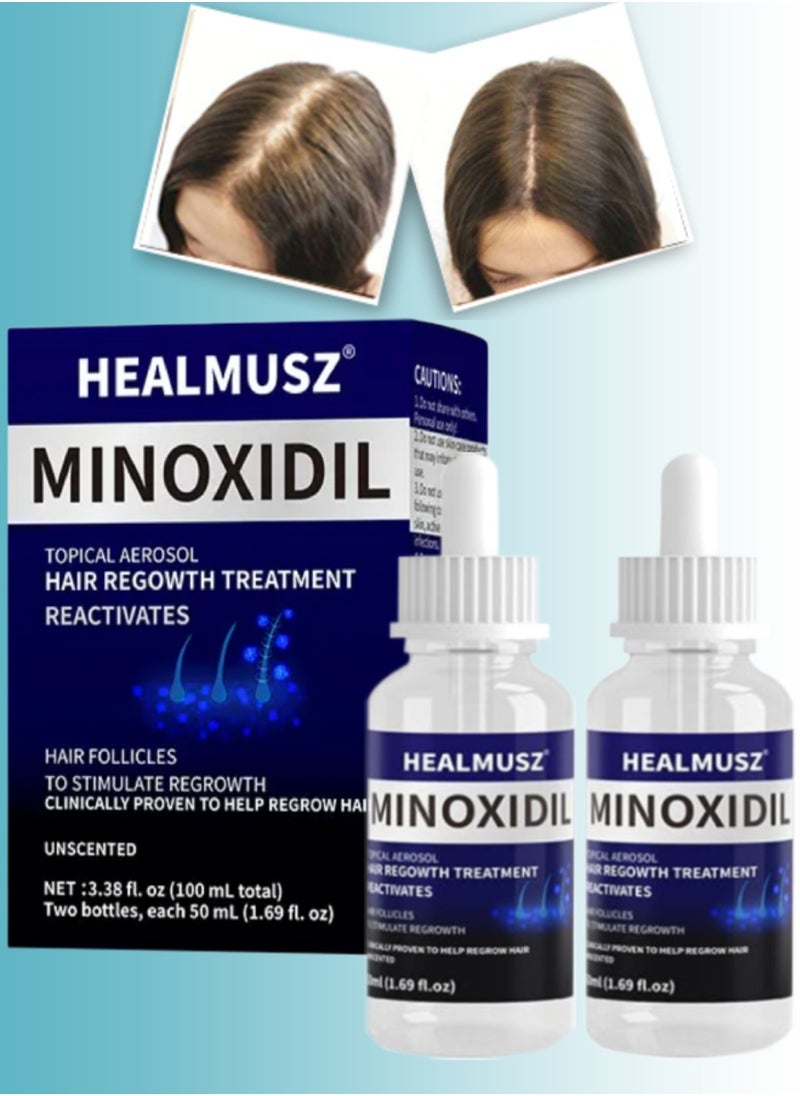 HEALMUSZ - 2Pcs Minoxidil Hair Growth Treatment Reactivate Hair and Beard Follicles for Hair Growth Men and Women Minoxidil Solution Serums 5% Minoxidil Hair Regrowth Treatment Serum 2x50ml - Image 1