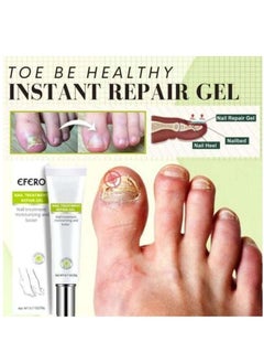 efero 3 Pack Nail Treatment Repair Gel Nail Repair Cream for Restores Appearance of Discolored or Damaged Nails (20g x 3)  - Image 5