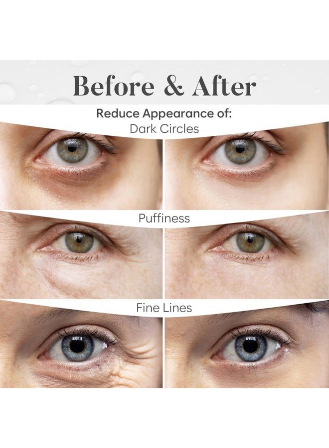 BLOOMORA Variety Under Eye Mask (30 Pairs) Under Eye Patches for Dark Circles, Under Eye Patches for Puffy Eyes and Dark Circles, Eye Masks Bulk, Eye Care, Puffy Eyes Treatment - Image 4