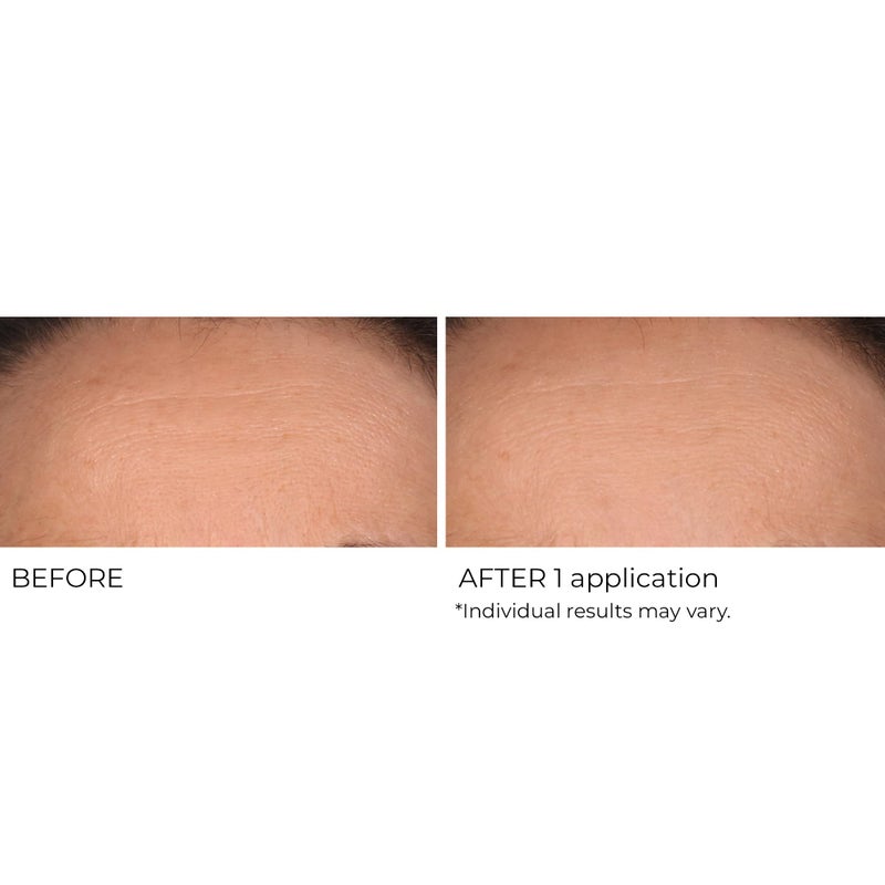 NassifMD Wrinkle Blur Targeted Treatment - Image 3