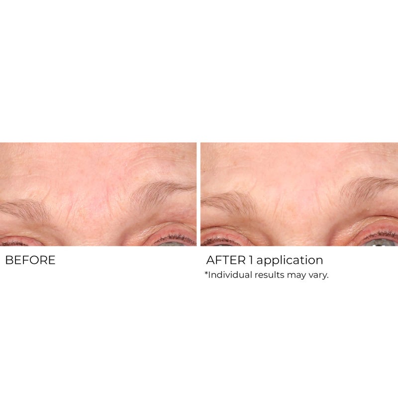 NassifMD Wrinkle Blur Targeted Treatment - Image 4