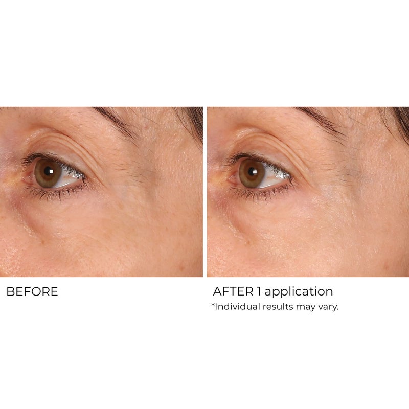 NassifMD Wrinkle Blur Targeted Treatment - Image 2