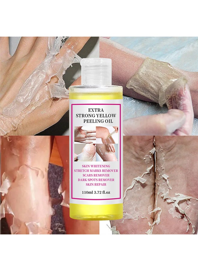 Elaimei Yellow Peeling Oil 110ML Super Strength Dead Skin Remover Skin Moisturizing Hydrating Butter Peeling Remove Dead Skin And Calluses On Feet And Hand Dark Spot Peeling Oil  - Image 2