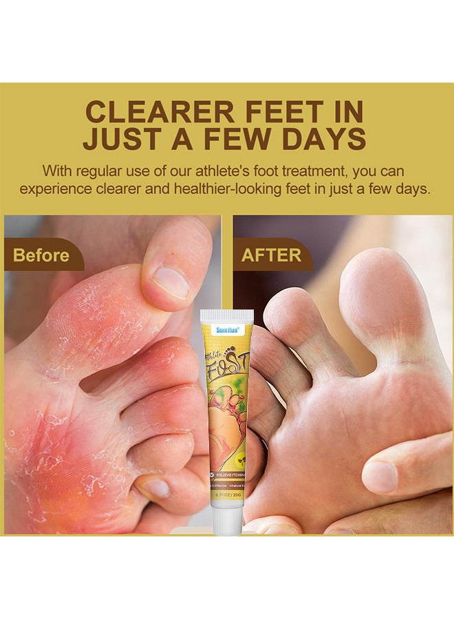 سوميفون 2PCS كريم القدم الرياضيين العمل المزدوج، كريم القدم رائحة القدم الرياضي، كريم مضاد للفطريات، كريم مضاد للبكتيريا لقدم الرياضيين، علاج التعقيم مكافحة العدوى إصلاح العناية بالقدم 20G - Image 2