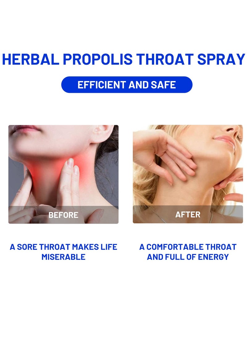 ximonth - Herbal Propolis Throat Spray Relieves cough, dryness, scratchy throat and discomfort Herbal Throat Care Spray Naturally immunizes and relieves sore throats - Image 1