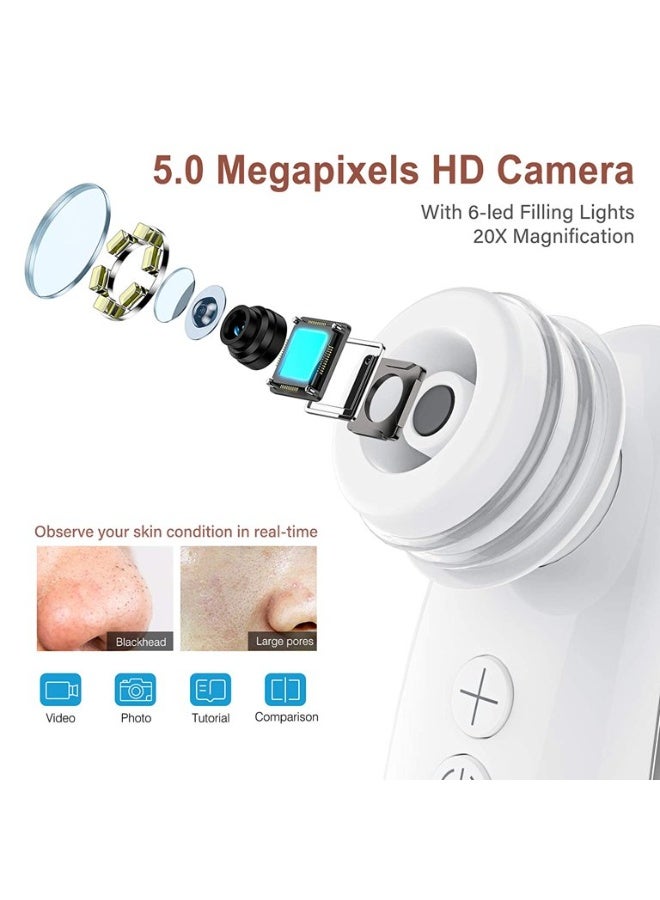 HD WiFi Electric Visual Blackhead Remover Pore Cleaner Professional Facial Cleansing Vacuum Blackhead Suction Device - Image 4