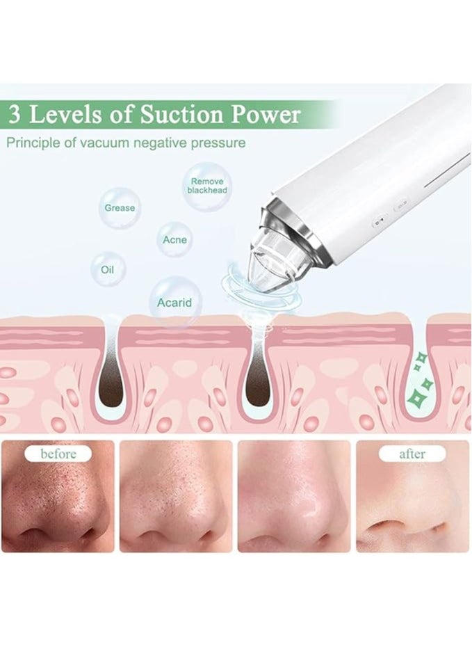 Generic - Blackhead Remover Pore Vacuum, WiFi Visible Facial Pore Cleanser With HD Camera Pimple Acne Comedone Extractor Kit With 6 Suction Heads Electric Blackhead - Image 1
