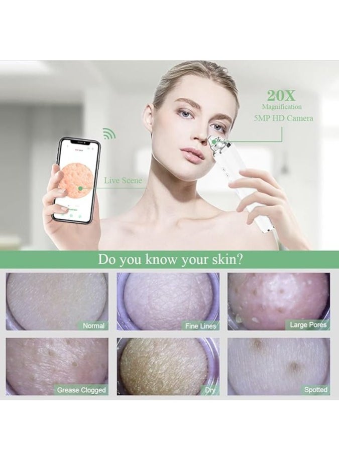 Generic - Blackhead Remover Pore Vacuum, WiFi Visible Facial Pore Cleanser With HD Camera Pimple Acne Comedone Extractor Kit With 6 Suction Heads Electric Blackhead - Image 1