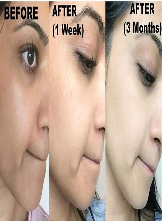 Kojie Original Kojie San Facial Beauty Soap 65g 2 Bars Per Pack - Image 5