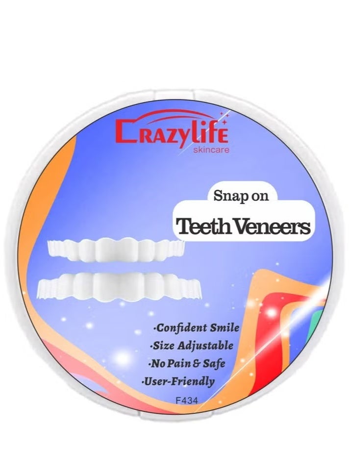 حياة مجنونة Teeth Veneers Anti-true Braces Snap On Smile Teeth Whitening Denture Teeth Comfortable Veneer Cover Teeth - Image 4