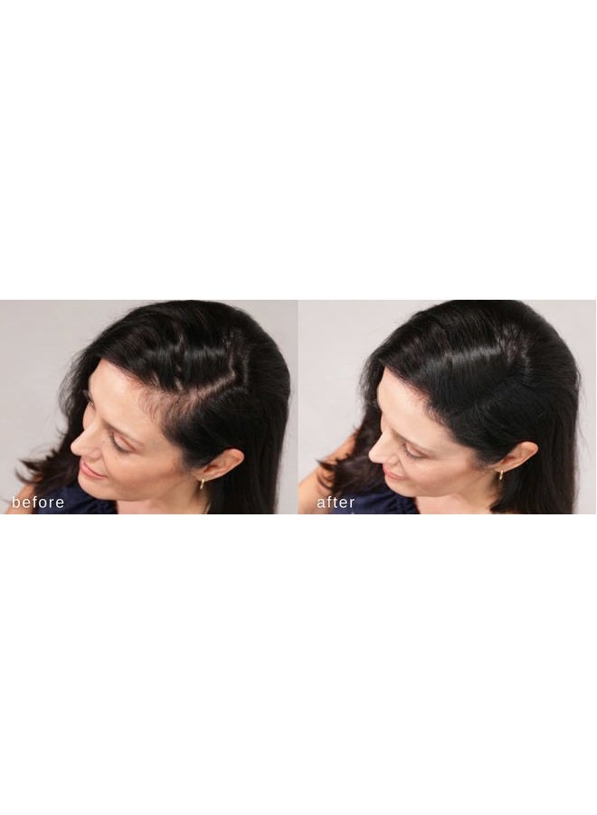 LUXE Professional Hair Thickening Fibers - CONFIDENCE IN A JAR – 2 Months+ Supply! – Hypoallergenic, Dermatologist Tested – Multiple Colors Available (White) - Image 3