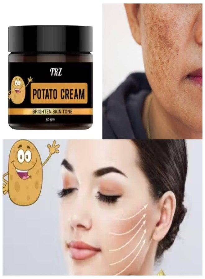 TRZ Hyper Pigmentation Cream Solution Gel Potato Cream - Image 2