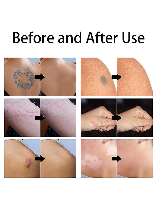 LANEMAY - Tattoo Concealer，Tattoo Concealer Smudge Resistant Skin Perfecting Long Lasting Body Foundation-30g - Image 1