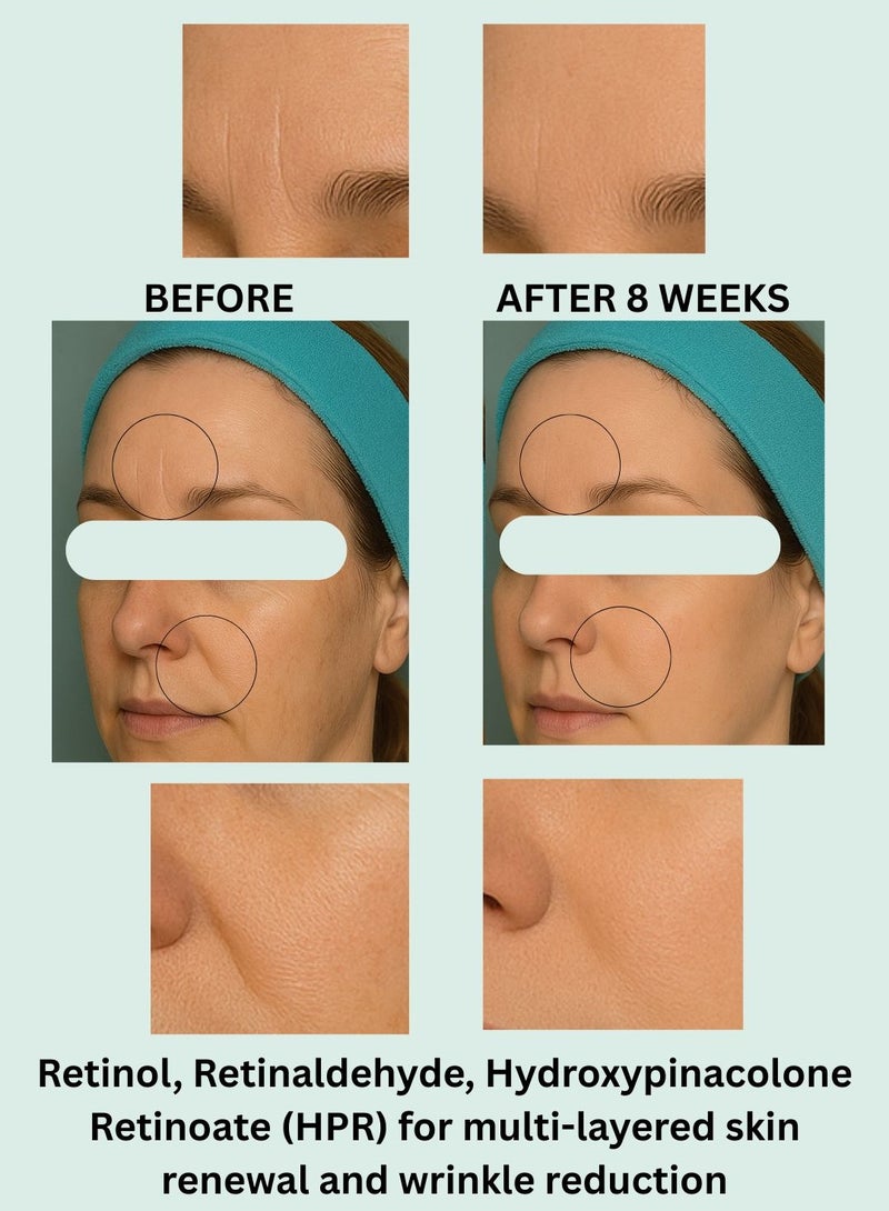 BONITTO® PRO TIME Advanced Anti-Aging Night Serum with Triple Retinoid Complex (Retinol, Retinaldehyde, HPR), PDRN & Hyaluronic Acid – 30ml - Image 3