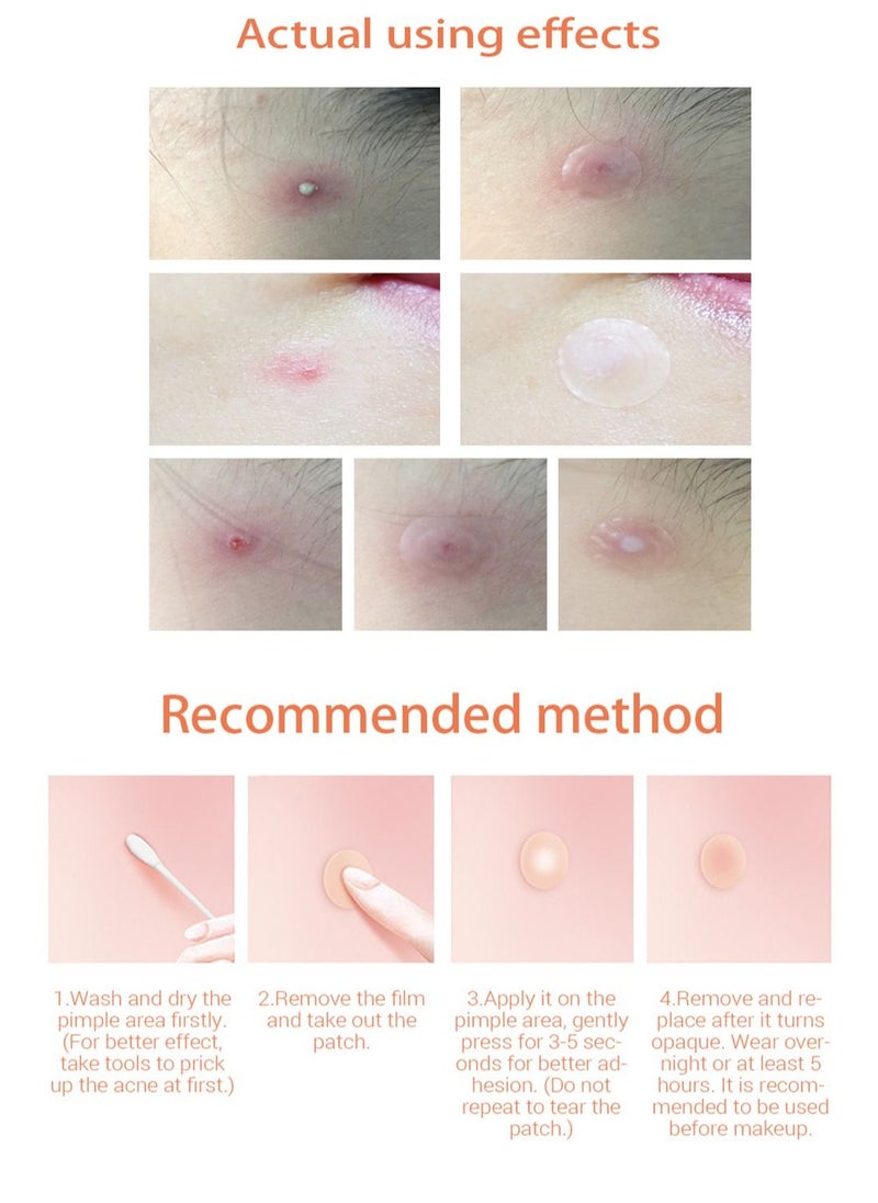 LANBENA - Night Acne Pimple Patch 28 Pieces - Image 1