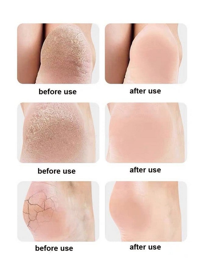 MLD جوارب كعب السيليكون MLD SHS-771 لإصلاح الكعب الجاف والمتشقق، لتخفيف تورم وألم الكعب للرجال والنساء (بيج، مقاس مجاني) - Image 4