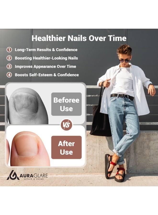 AuraGlare Effective Nail Fungus Management Device: Advanced Light Therapy with 30 LED Beads & Customizable Settings for Optimal Results - Image 2