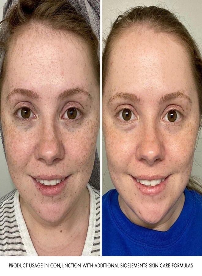 Bioelements. Quick Refiner for Eyes - 0.5 fl oz - Wrinkle-Reducing, Gentle AHA & Lactic Acid Peel for Eyes - All Skin Types - Vegan, Gluten Free - Never Tested on Animals - Image 5