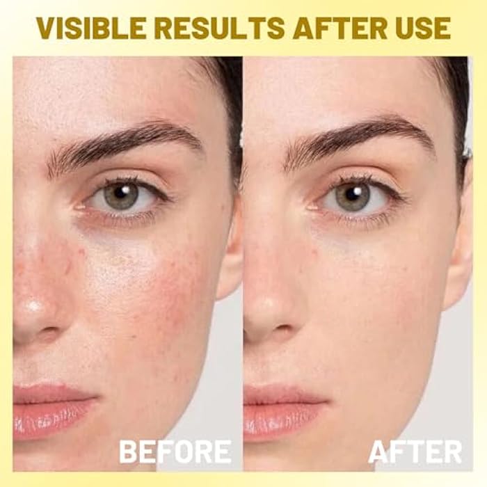 IREV كبسولات فيتامين سي العميق من IREV لترطيب الوجه، كريم وجه مرطب، جل شفاف لبشرة متألقة، عناية بالبشرة ليلاً، كريم هلامي للبشرة الباهتة وغير المتساوية 4.9 أونصة - Image 3