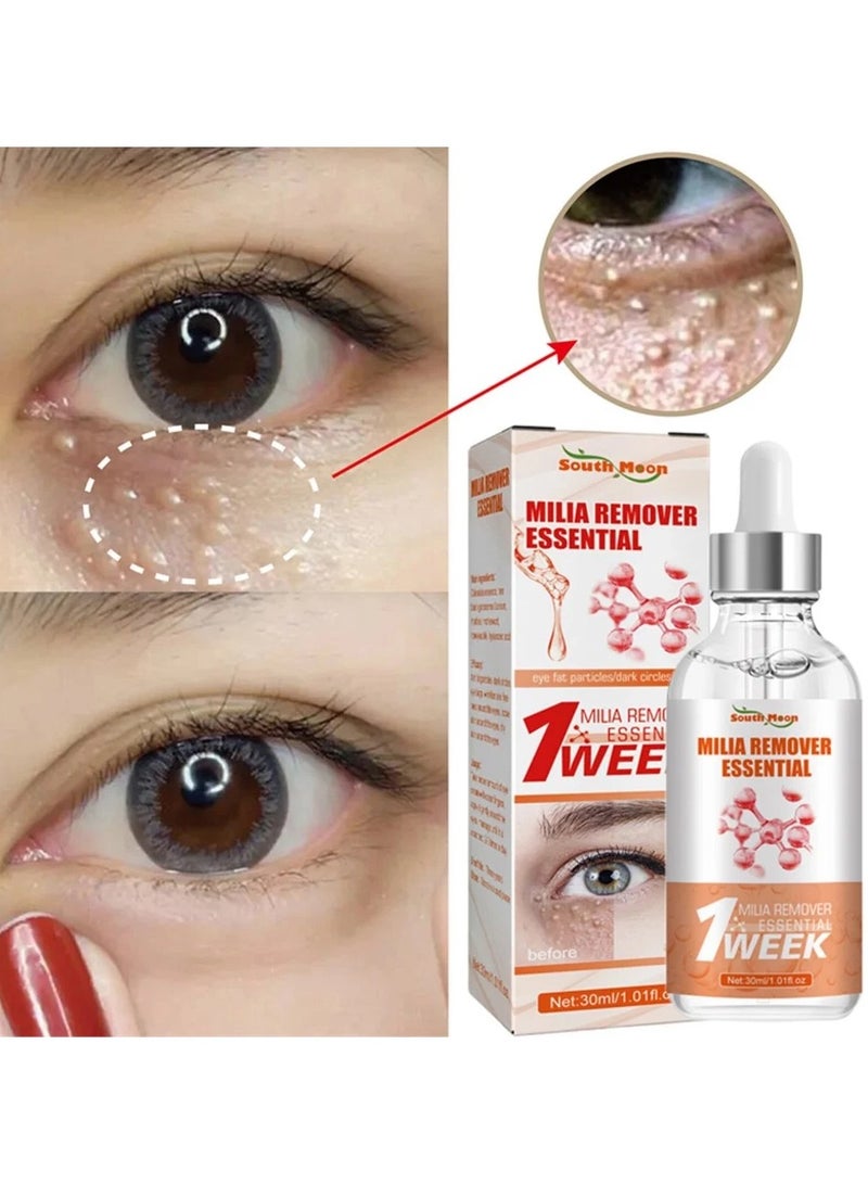 SOUTH MOON Milia Remover Essential Eye Serum Effective Removes Fat Granules - Image 4