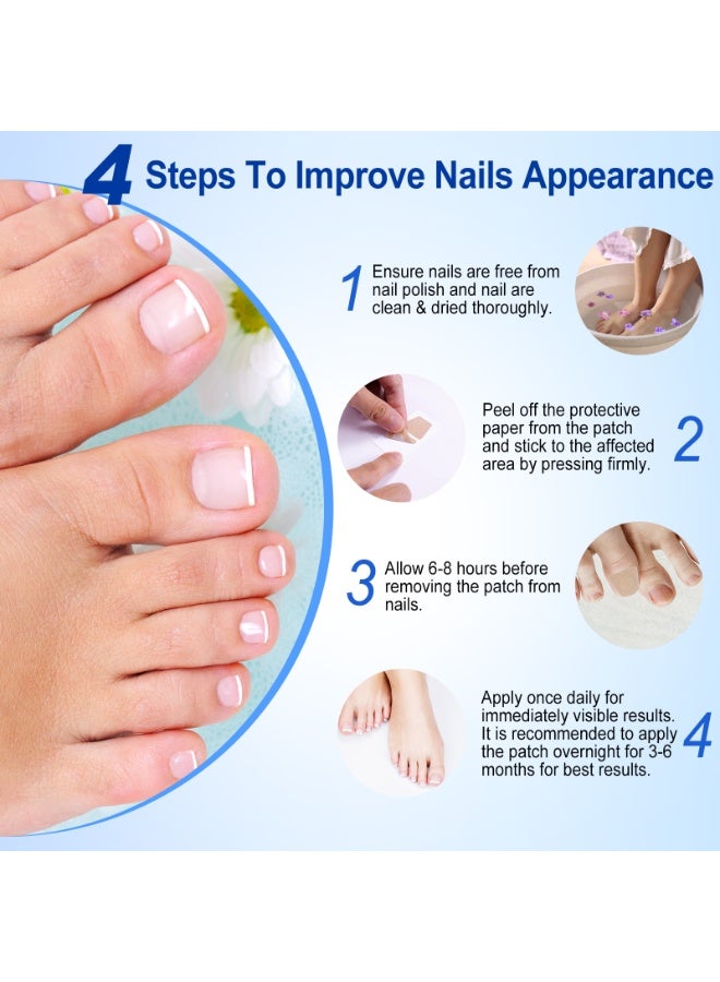 SEFUDUN nail repair patch, ingrown nails, onychomycosis, thick nails, correction patch, nail art, brittle nail care patch 60pcs - Image 3