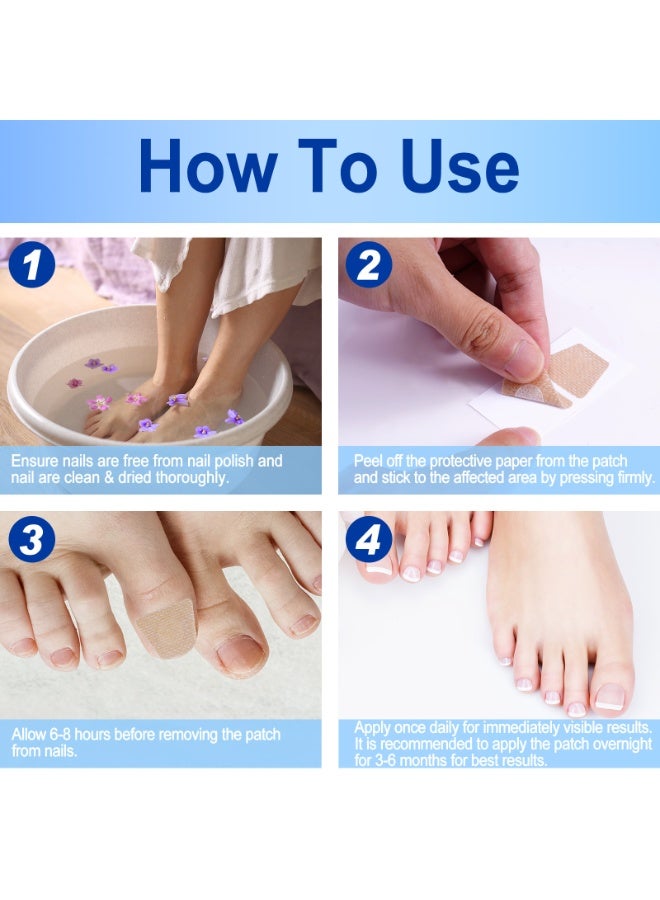 SEFUDUN nail repair patch, ingrown nails, onychomycosis, thick nails, correction patch, nail art, brittle nail care patch 60pcs - Image 4