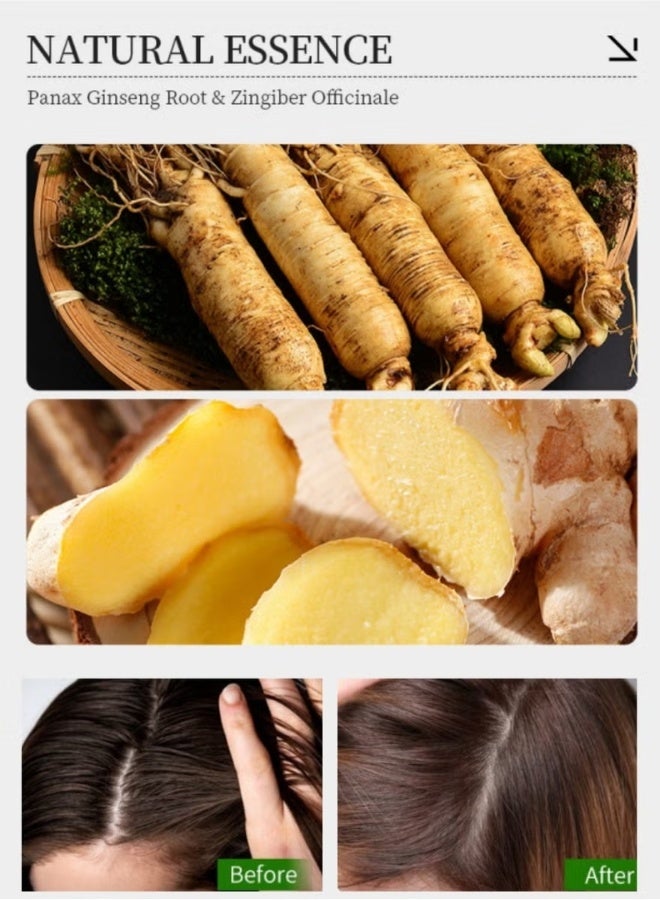 Kormesic 5% Minoxidil Biotin Shampoo 260ML Hair Growth Treatment Shampoo with Minoxidil 5% Strengthen Hair Promote Hair Regrowth Reduce Hair Loss Removes Dandruff & Relieve Itching for Women And Men - Image 5