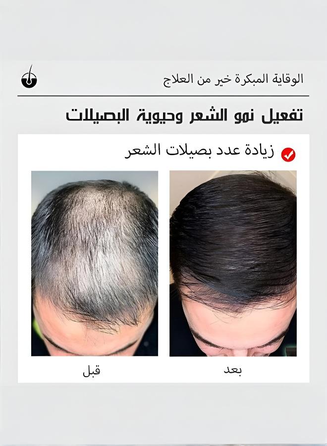 Rosemary Oil for Hair Care: Prevents Hair Loss, Promotes Growth, and Nourishes Scalp - Image 4