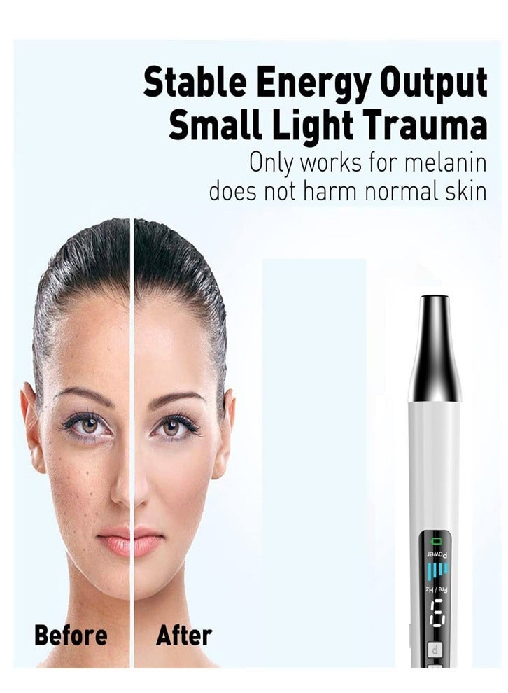 Handheld Laser Picosecond Skin Tattoo Dark Spot Removal Laser Pen Beauty Device（Blu-ray） - Image 2