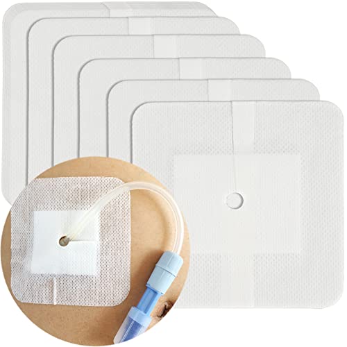 DiaBelt Peritoneal Dialysis PD Catheter Drain Split Bordered Gauze Island Dressing Pad for Stomach Feeding Peg J Tube| Individually Packed| Wound Bandage with Adhesive Border 4" x 4" (Pack of 20) - Image 1