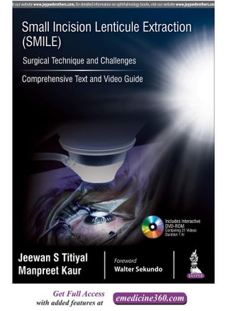Small Incision Lenticule Extraction (SMILE): Surgi: Comprehensive Text and Video Guide - pzsku/Z2C3440DE8CAEC484CE3AZ/45/_/1731331191/affe5171-e623-4b23-b70a-625fcd172ea0