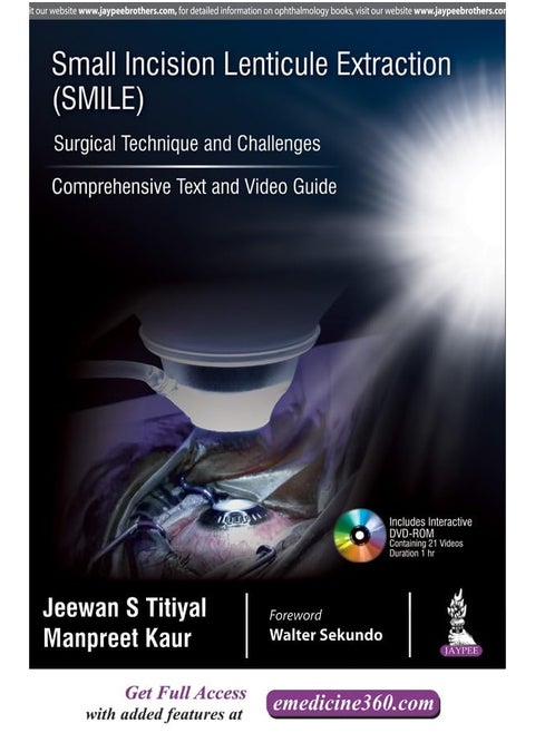 Small Incision Lenticule Extraction (SMILE): Surgi: Comprehensive Text and Video Guide