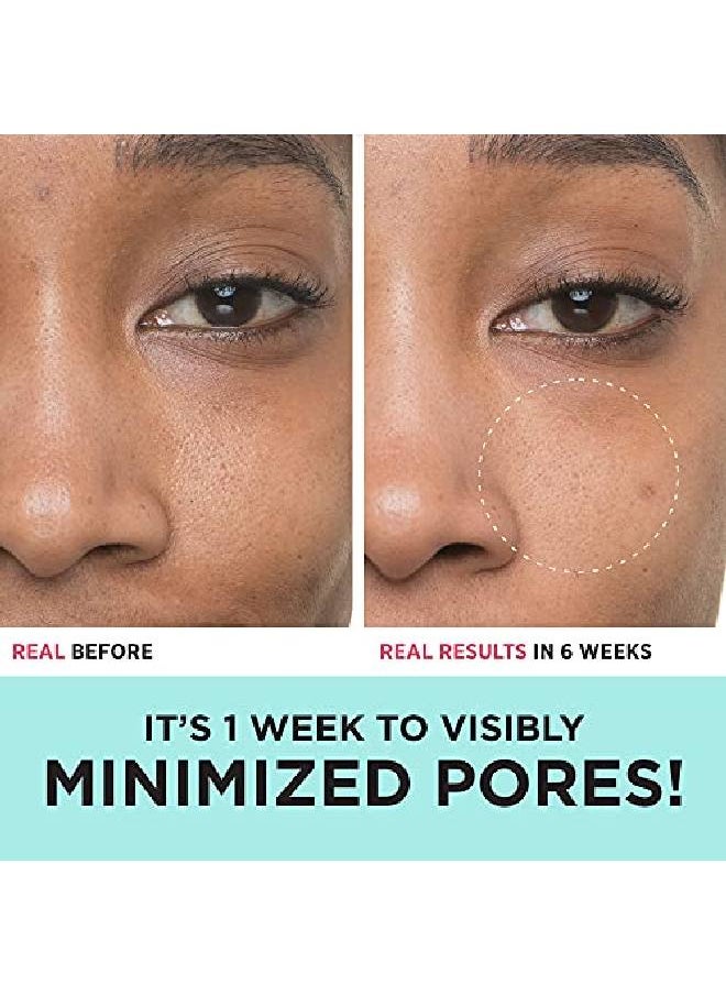 IT COSMETICS - Bye Bye Pores 10% Glycolic Acid Serum Visibly Minimizes Pores In 1 Week & Exfoliates To Help Refine Skin’S Texture With Hyaluronic Acid Vegan Formula 1 Fl Oz - Image 1