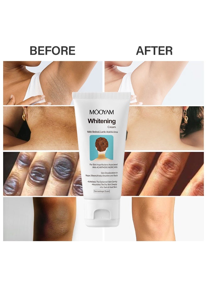 موويام مجموعة علاجية لتفتيح البشرة وإزالة الندبات تحتوي على حمض اللاكتيك واليوريا للندبات الداكنة وعلامات التمدد والبقع الداكنة. تحسن ملمس البشرة لجميع أنواع البشرة. - Image 5