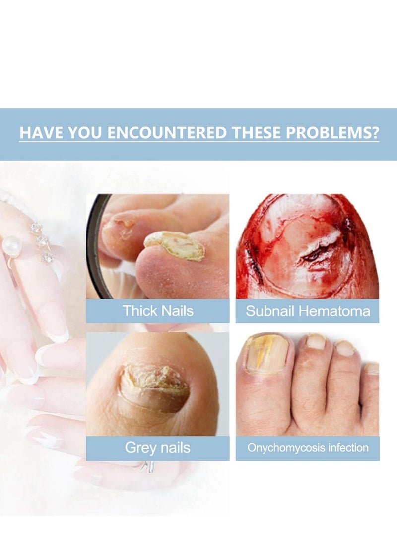  اوساورا مصل نمو الأظافر وإصلاحها ، مصل نمو وإصلاح الأظافر Onyxoguard ، مصل نمو الأظافر Onyxoguard ، مصل إصلاح الأظافر ، مقوي الأظافر للأظافر التالفة ، مقوي الأظافر للنمو والقوة 15 مل - Image 4