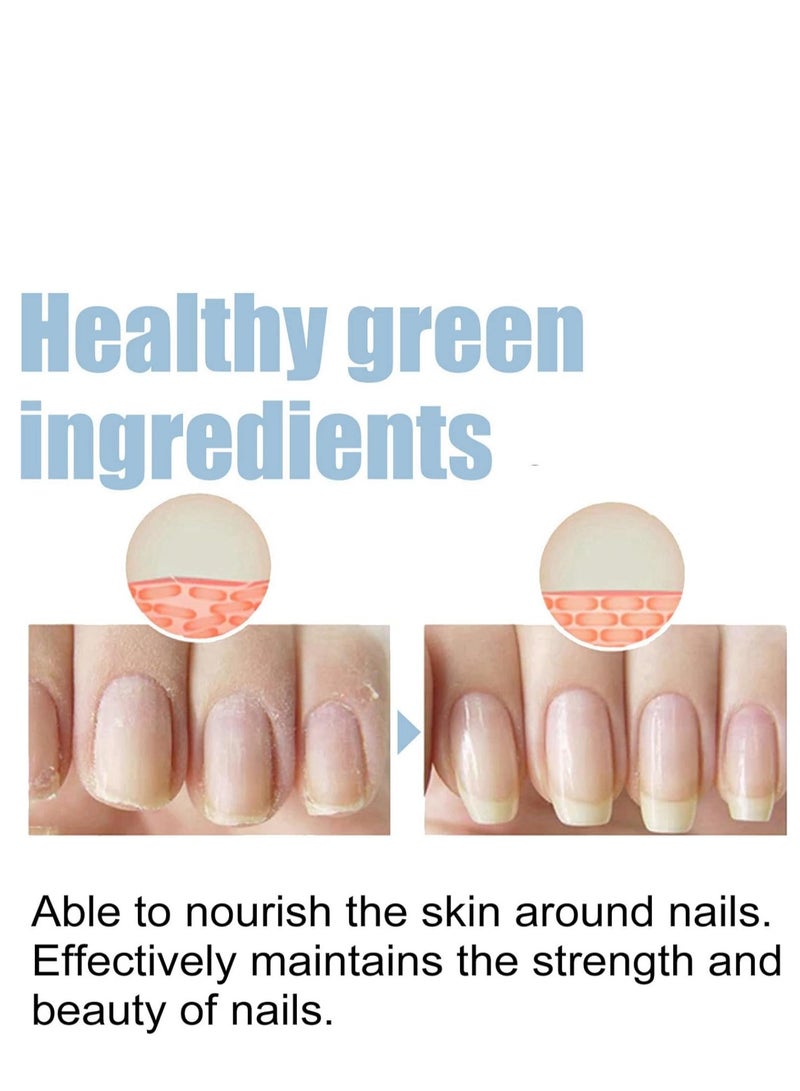  اوساورا مصل نمو الأظافر وإصلاحها ، مصل نمو وإصلاح الأظافر Onyxoguard ، مصل نمو الأظافر Onyxoguard ، مصل إصلاح الأظافر ، مقوي الأظافر للأظافر التالفة ، مقوي الأظافر للنمو والقوة 15 مل - Image 5