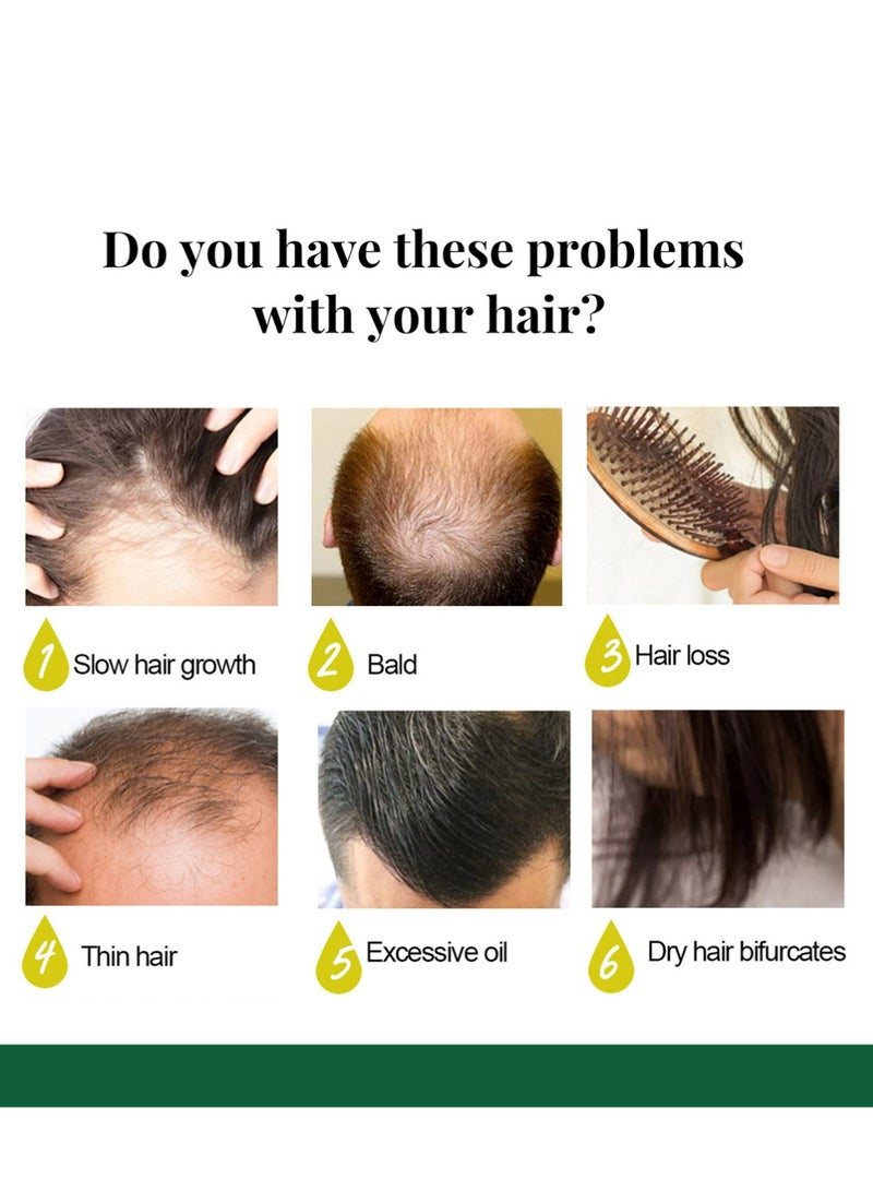 EELHOE Ginger Oil for Hair Growth, 7 Days Germinal Oil, Hair Fall Control, Dry Hair Treatment, Natural Ingredients, Japanese Formula, Unisex, Includes 1 Pc 50ml - Image 4