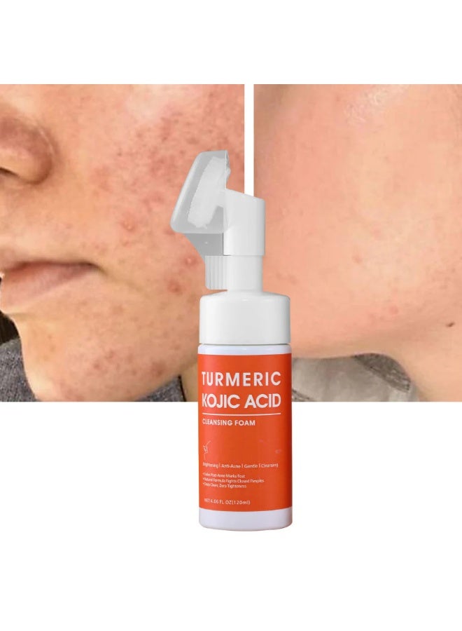 CKTUING Turmeric Kojic Acid Facial Cleanser, Brightening Foaming Makeup Remover, Turmeric Cleansing with Brush Head for Dark Spots 4.23 oz - Image 2