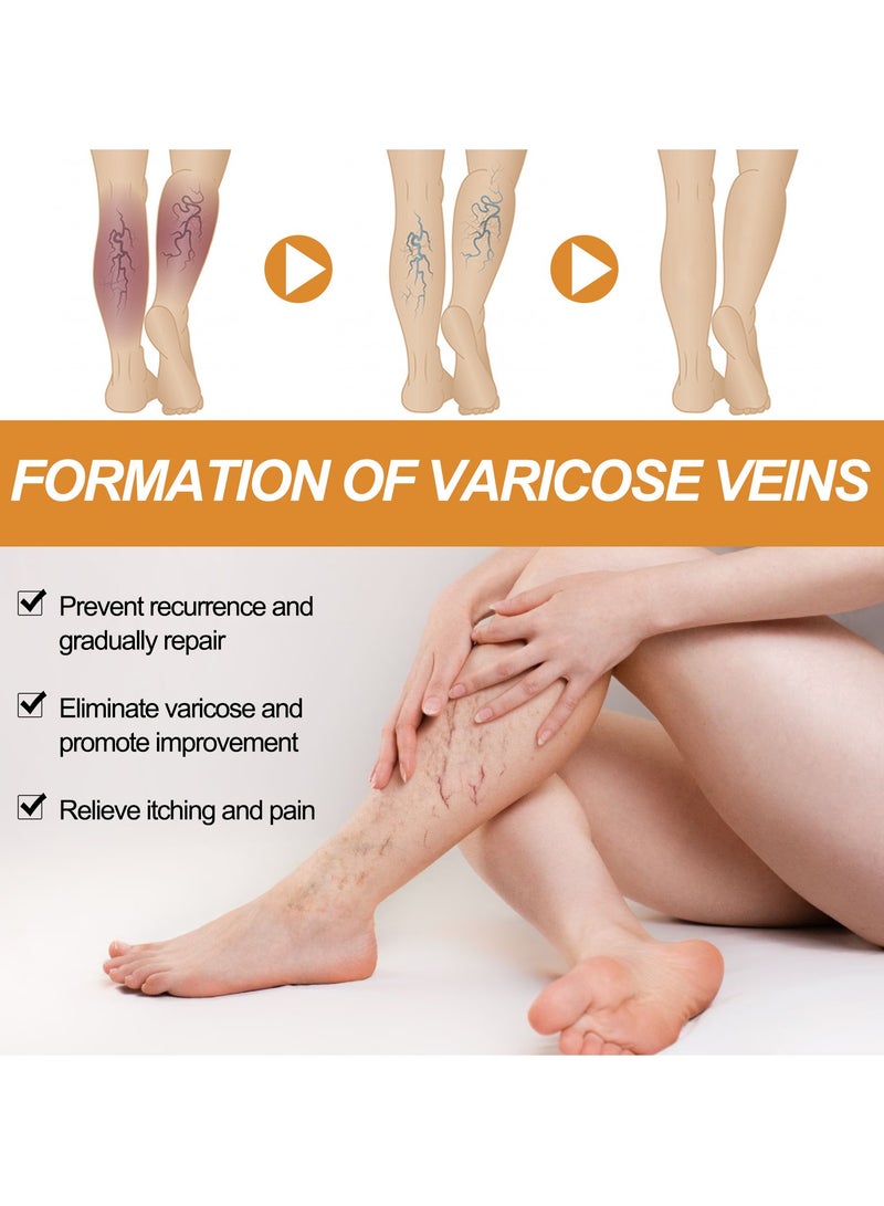 SOUTH MOON 3-PACK Varicose Vein Soothing Spray, Reduce Varicose Veins, Relieve Swelling And Pain 30ml*3  - Image 4
