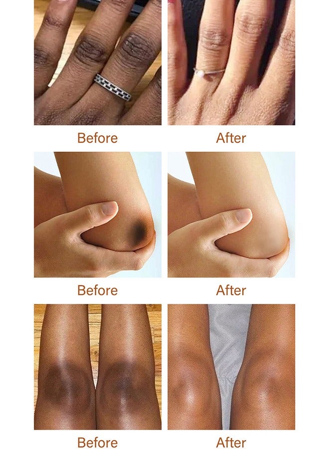 CARVENCHY Dark Knuckle Whitening Serum - Skin Whitening Oil Brightening Dark Spots,Obvious Useu Effect，Get Rid of Knuckles Easily In Just 7 Days，Whitening Knee Melanin with Glow Essence,30 ml - Image 3