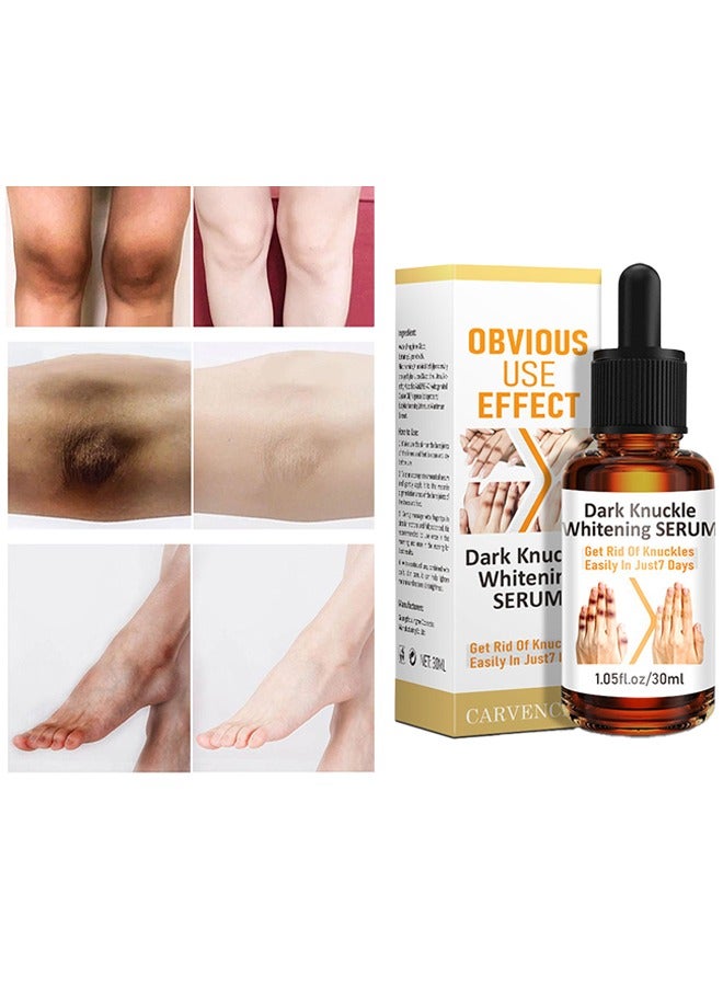 CARVENCHY Dark Knuckle Whitening Serum - Skin Whitening Oil Brightening Dark Spots,Obvious Useu Effect，Get Rid of Knuckles Easily In Just 7 Days，Whitening Knee Melanin with Glow Essence,30 ml - Image 2