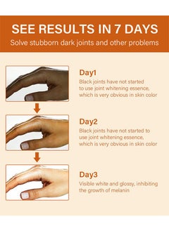 CARVENCHY Dark Knuckle Whitening Serum - Skin Whitening Oil Brightening Dark Spots,Obvious Useu Effect，Get Rid of Knuckles Easily In Just 7 Days，Whitening Knee Melanin with Glow Essence,30 ml  - Image 5
